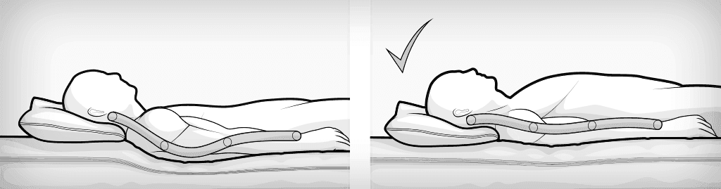 zweigeteilte Illustration links: ein Mensch in Rückenlage auf der Matratze, die Schulterzone sinkt zu tief ein, die Wirbelsäule wird gestaucht, rechts: ein Mensch in für die Wirbelsäule optimal gelagerter Rückenlage