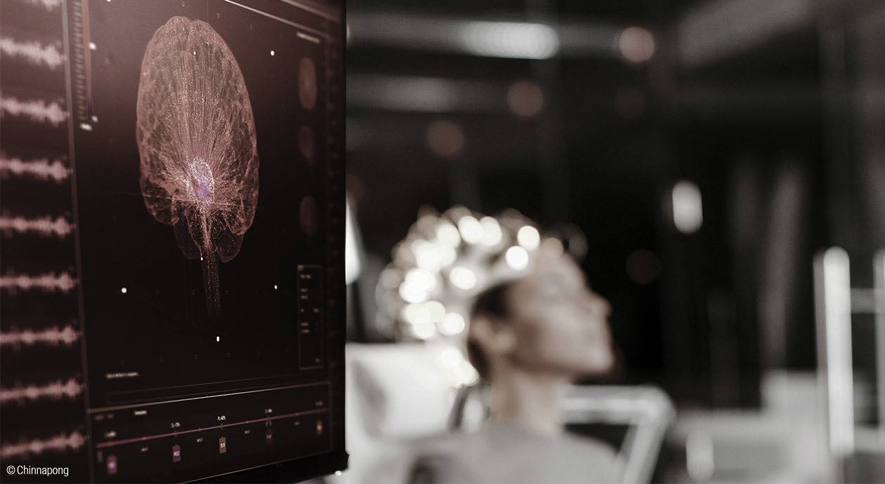 Symbolfoto Schlaflabor: Im Vordergrund ein Monitor auf dem Nervenstränge und Synapsen eines Gehirns aufleuchten. Im verschwommenen Hintergrund trägt eine Frau eine eine Kappe mit leuchtenden Sensoren.