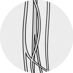 Illustration: Blutgefäße